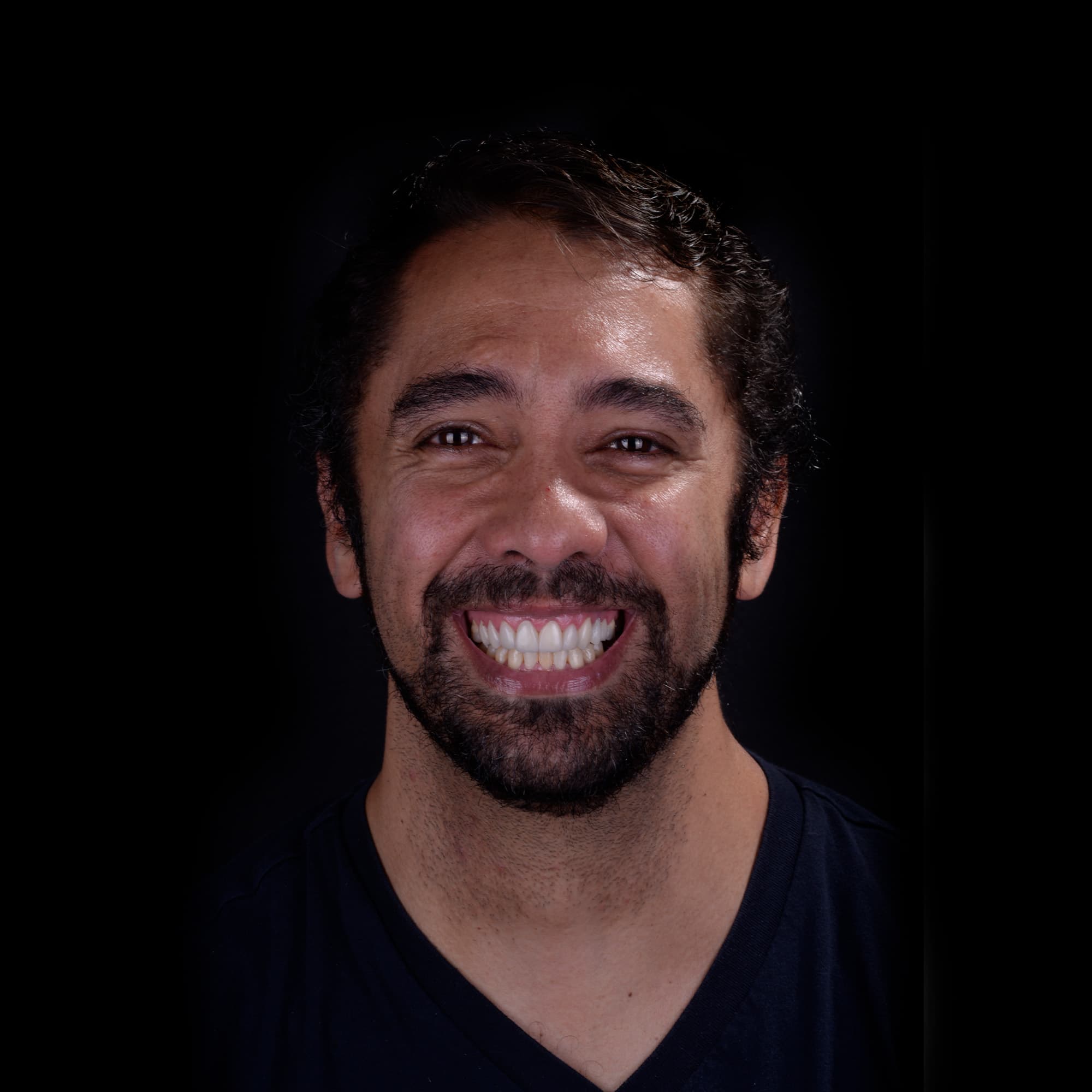 Periodontics in Polanco, Mexico City - Dentology Dental Boutique